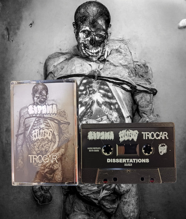 Lipoma / Fluids / Trocar (2) : Dissertations (Cass, EP)